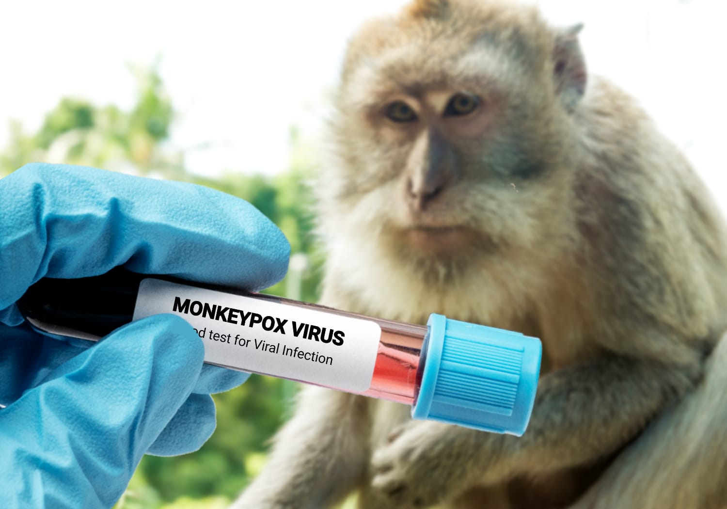 monekypox atau virus cacar monyet